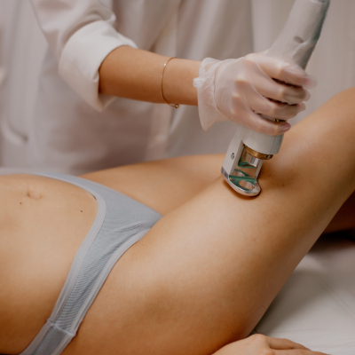 Лазерная эпиляция светлый волос