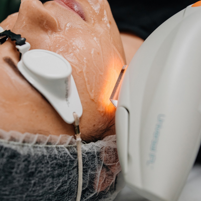 Фотоомоложение Lumenis M22