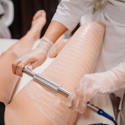 РФ лифтинг Indiba