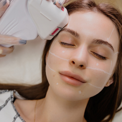 СМАС лифтинг 