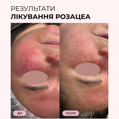 Изображение из Instagram