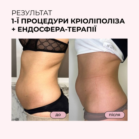 Изображение из Instagram